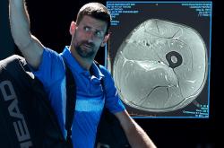 开云体育登录-德国网球队完胜日本网球队，德约科维奇完成帽子戏法的简单介绍